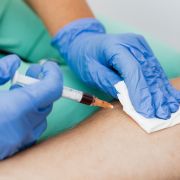 Jak číst svůj hormonální krevní panel: Odborný průvodce výsledky z laboratoře